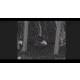 ATN BlazeTrek-625 1.7x - 13.5x Thermal Imaging Monocular 12 Micron, 640x512, Black, TIMNBLT625