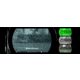 DNT Optics NVMD-C200 1-6x Night Vision Riflescope
