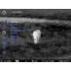 Pulsar Thermion 2 LRF XG50 3-24x50mm Thermal Riflescope, Multiple Reticle, 50 Hz, 640x480, Black, PL76554